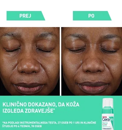 glycolysine-2025SL-clnically-proven